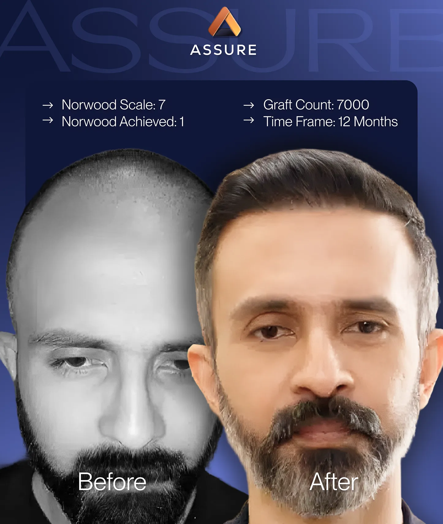 The proposed Assure creative: a before and after transformation card