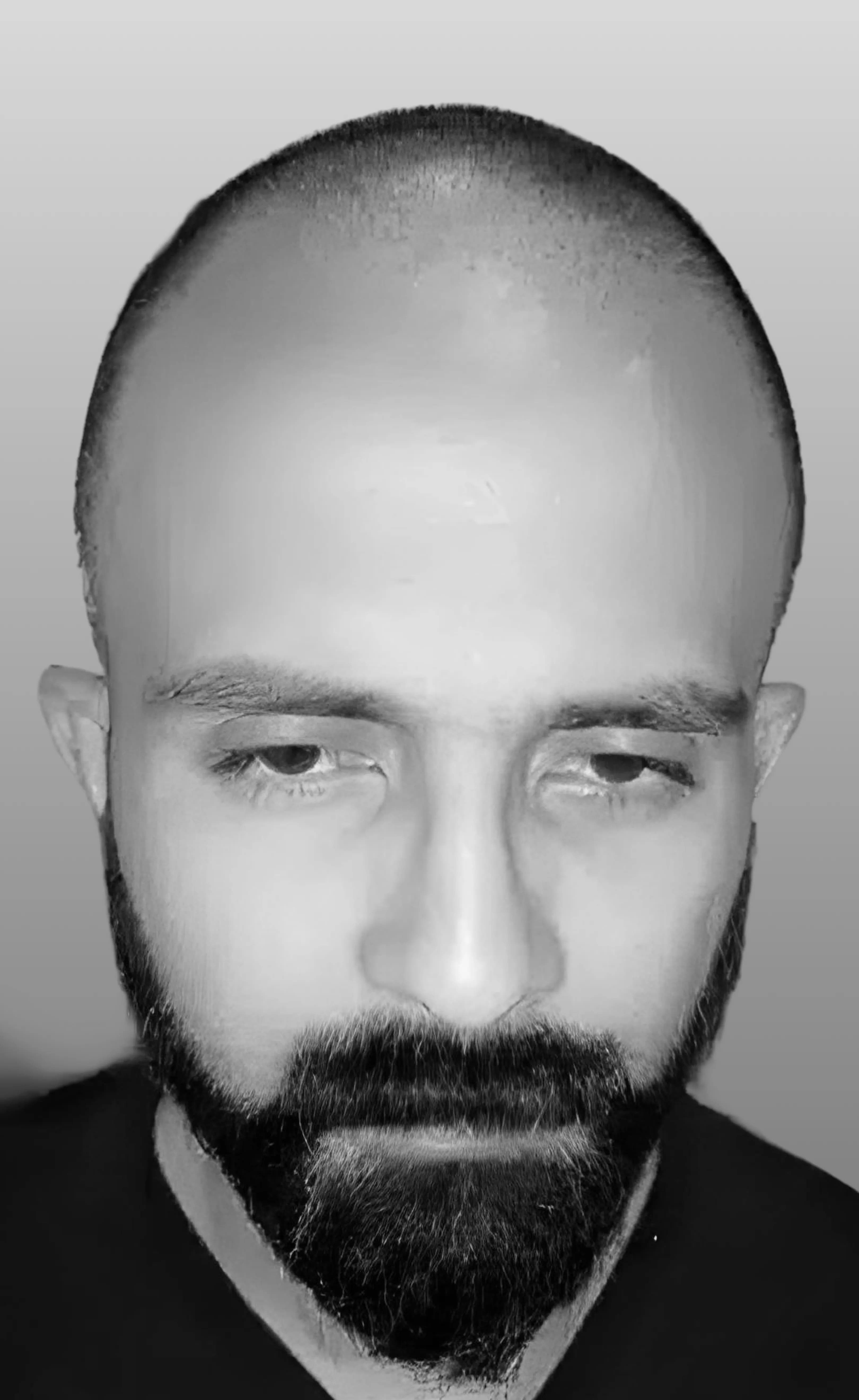 Case 01 — before treatment