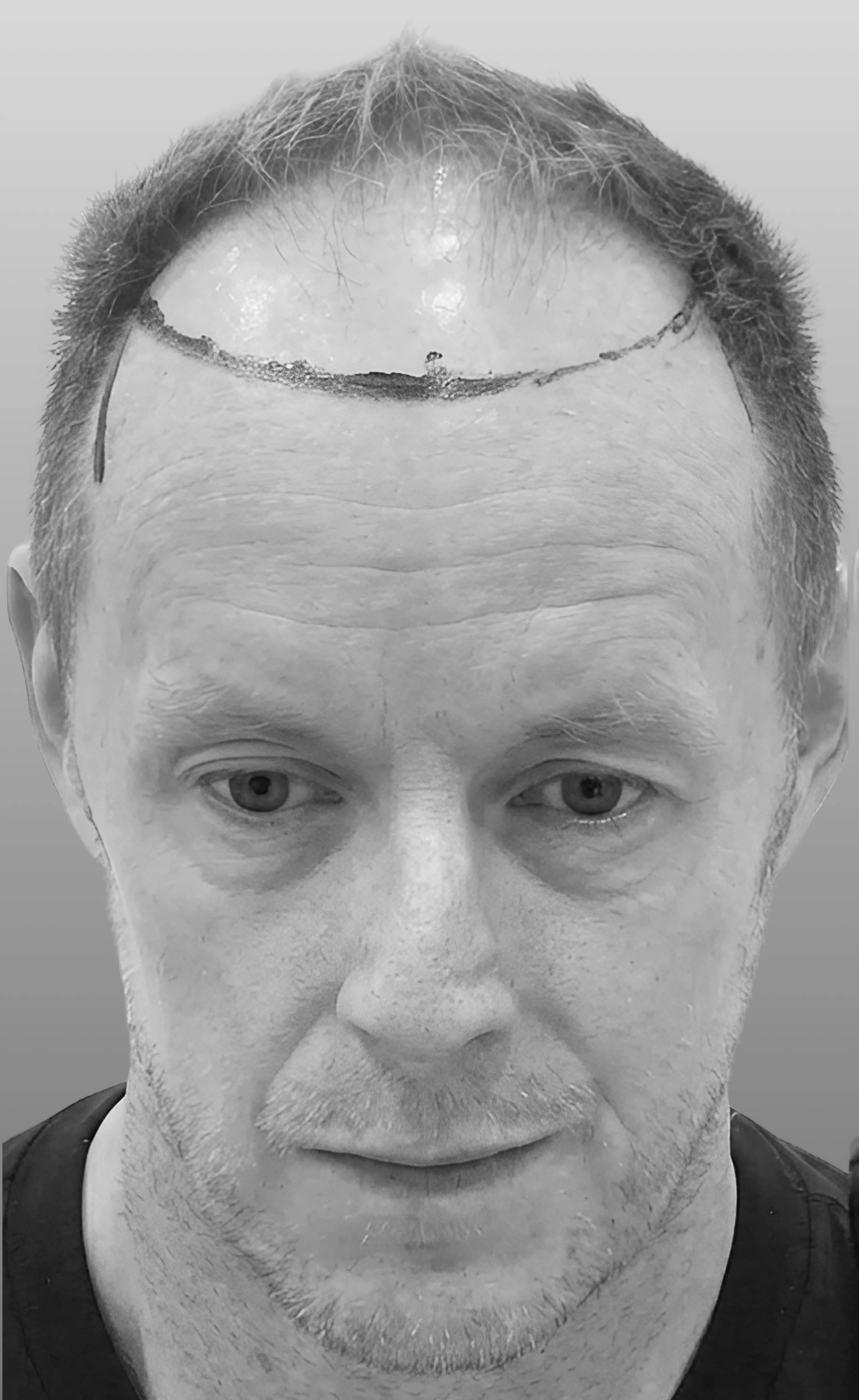 Case 02 — before treatment
