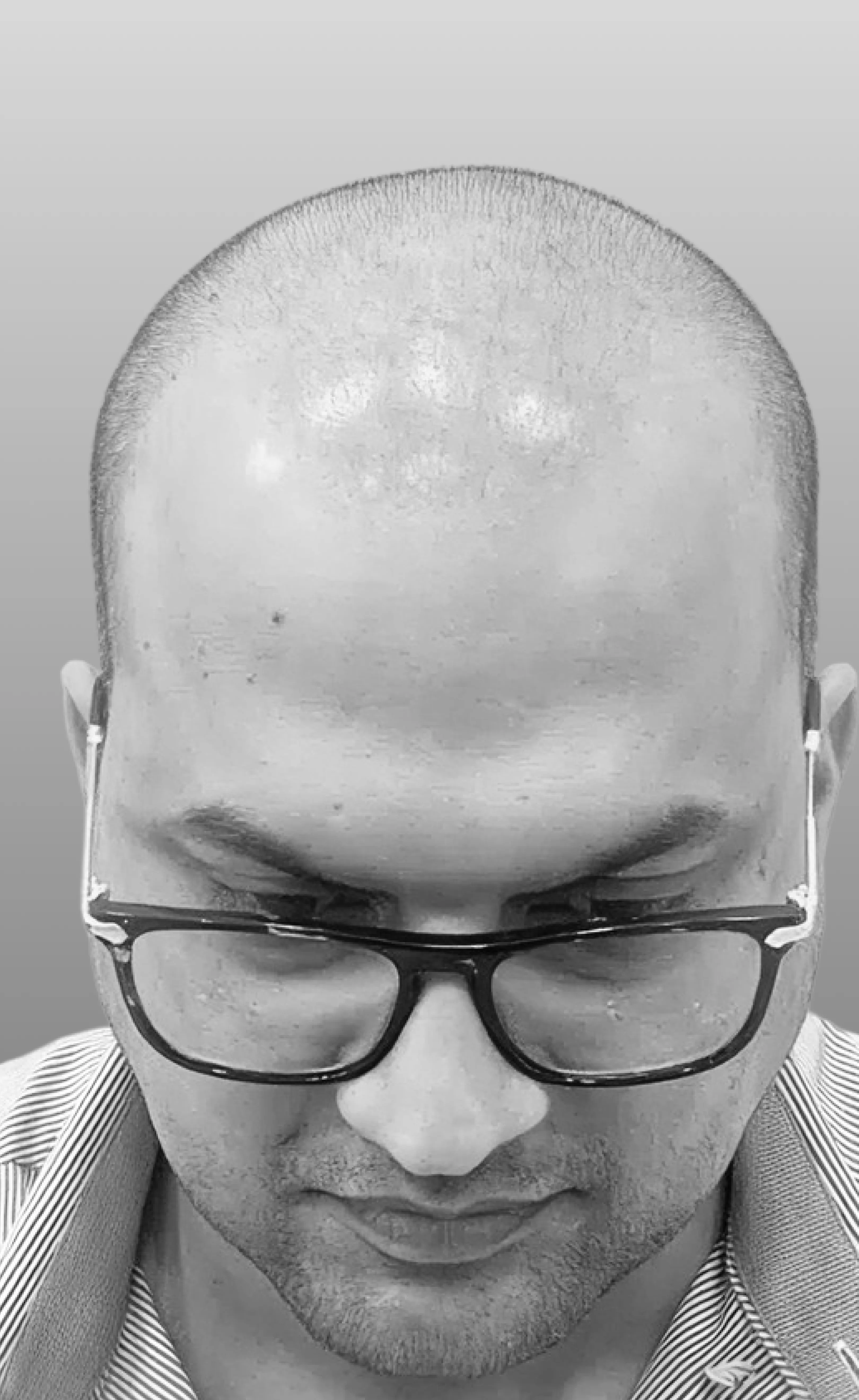 Case 04 — before treatment