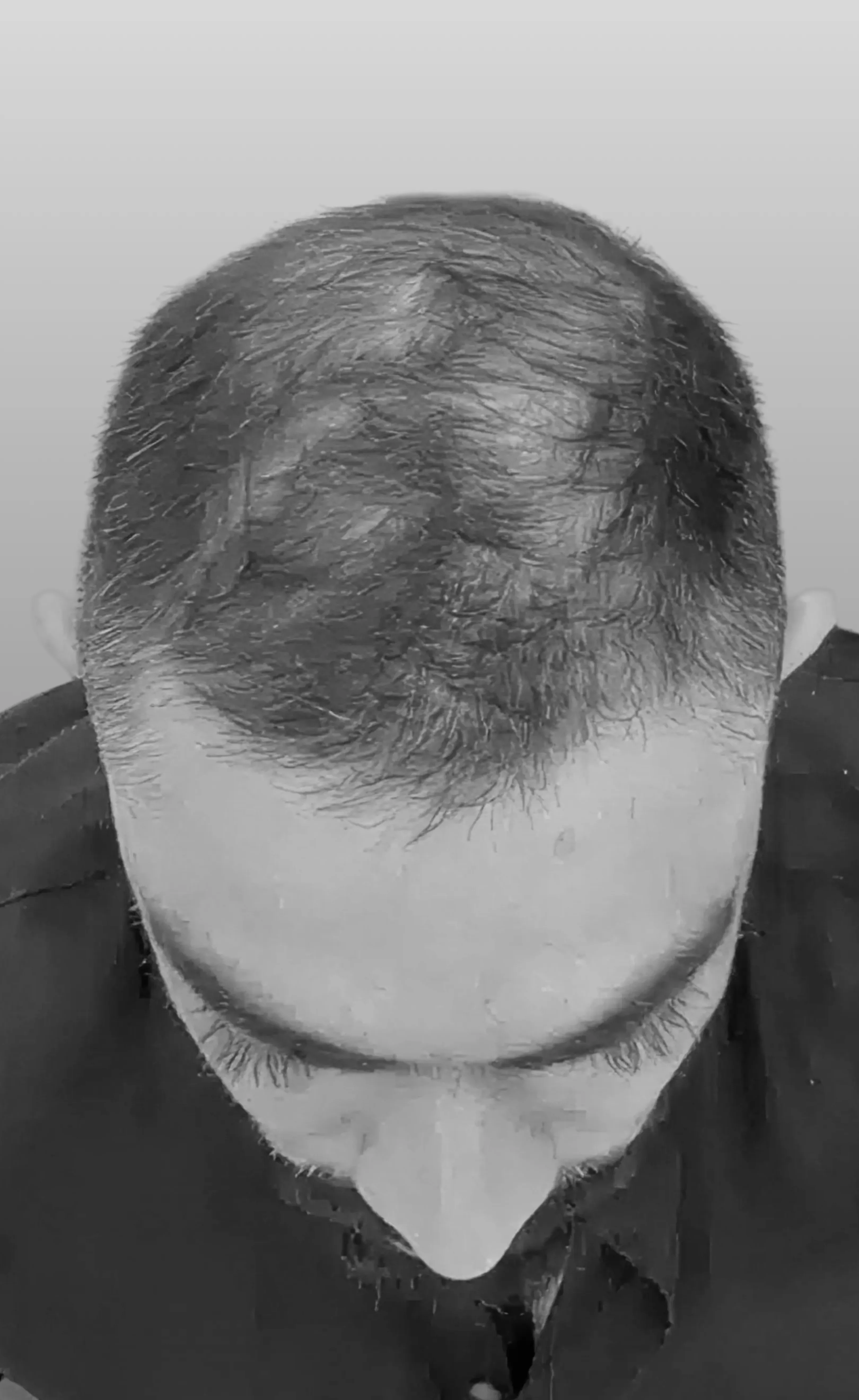 Case 05 — before treatment