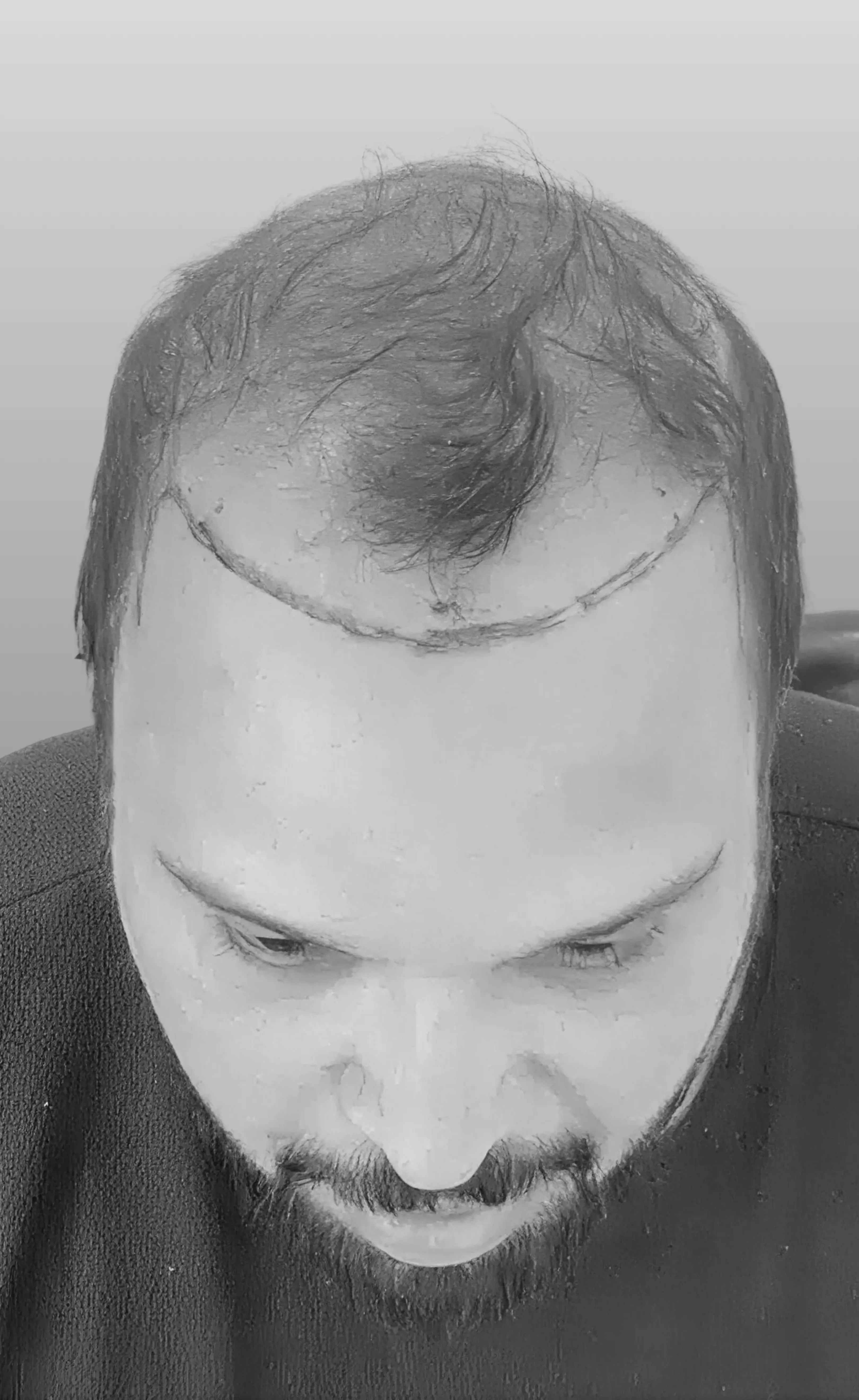 Case 06 — before treatment
