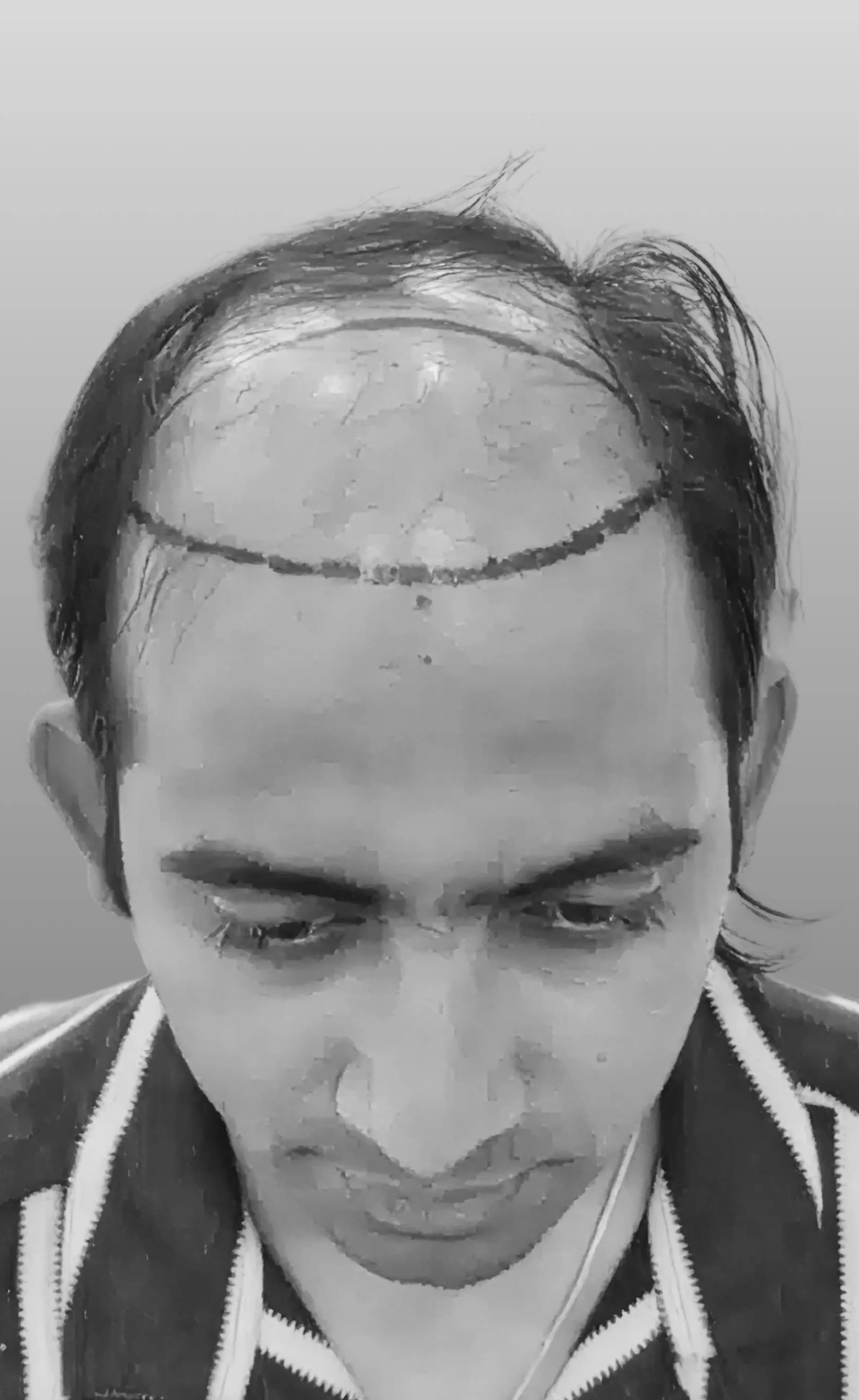 Case 07 — before treatment